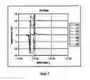 Fig. 07 - System and method for locating an anomaly