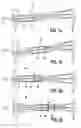 Fig. 02 - Zoom lens