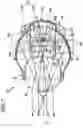 Fig. 08 - Vehicle headlamp