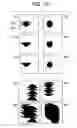 Fig. 11 - System and method for an adaptive morphology x-ray beam in an x-ray system