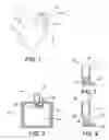 Fig. 02 - Pressurized chewing gum compositions and dispensing method