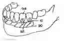 Fig. 01 - Dental implant