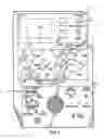 Fig. 02 - Method of transporting and storing a kidney