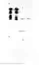 Fig. 23 - Cloning and expression of microbial phytase
