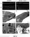 Fig. 07 - Methods for the treatment of tinnitus induced by cochlear excitotoxicity