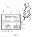 Fig. 02 - Bio-filter pad for facilitating the detection of an occurrence of a physiological action and method therefor and fetal activity monitoring apparatus