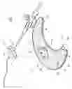Fig. 02 - Anchoring system for a medical article