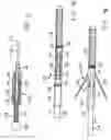 Fig. 07 - Mechanical thrombectomy device for use in cerebral vessels