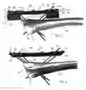 Fig. 02 - External fixation device for fractures