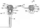 Fig. 01 - Rod attachment for head to head cross connector