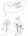 Fig. 02 - Vascular wound closure device