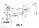 Fig. 02 - Method and apparatus for facilitating patient alert in implantable medical devices