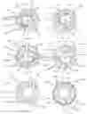 Fig. 05 - Accommodating intraocular lens device