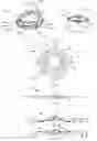 Fig. 06 - Accommodating intraocular lens device