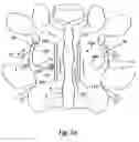 Fig. 03 - Interspinous process implant including a binder and method of implantation