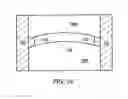 Fig. 24 - Lens forming systems and methods