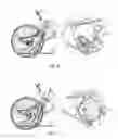 Fig. 07 - Lever enhanced pedaling system