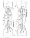 Fig. 02 - Dual-flow inflator