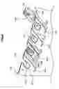 Fig. 07 - Image forming apparatus having a securing member to secure an image forming unit to a housing body
