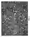 Fig. 04 - Topical nanoparticulate spironolactone formulation