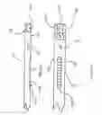 Fig. 04 - Orthodontic tool