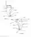 Fig. 06 - Orthodontic tool