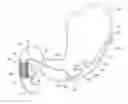 Fig. 01 - Radially expandable gastrointestinal stimulation device