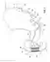 Fig. 02 - Radially expandable gastrointestinal stimulation device