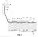 Fig. 06 - Radially expandable gastrointestinal stimulation device