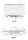 Fig. 09 - Radially expandable gastrointestinal stimulation device