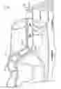 Fig. 02 - Method and apparatus for treating venous insufficiency