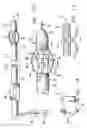 Fig. 06 - Method and apparatus for treating venous insufficiency