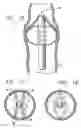Fig. 07 - Method and apparatus for treating venous insufficiency