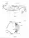Fig. 02 - Intraocular lens