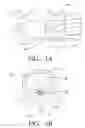 Fig. 02 - Posterior approach implant method for assembly of multi-piece artificial spinal disk replacement device in situ