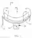 Fig. 02 - Modular glenoid prosthesis and associated method