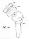 Fig. 28 - Extended articulation prosthesis adaptor and associated method