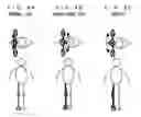 Fig. 09 - Joint device for artificial leg, method of controlling the joint device, and control unit