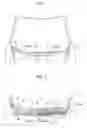 Fig. 02 - Wiper device