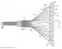 Fig. 01 - Braided stent and method for its manufacture