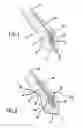 Fig. 02 - Tire with low zone comprising a concentration of cords