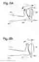 Fig. 07 - Exercise apparatus