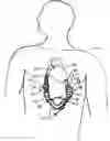 Fig. 01 - Heart pump connector
