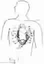 Fig. 02 - Heart pump connector