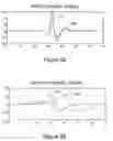 Fig. 09 - Arrhythmia classification and therapy selection