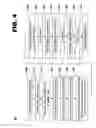 Fig. 05 - Stent delivery system