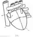 Fig. 02 - Devices and methods for access through a tissue wall