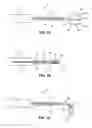 Fig. 02 - Medical retrieval device