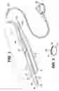 Fig. 02 - Method for implanting a fluid adjustable band