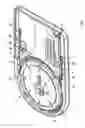 Fig. 02 - Embolic protection system